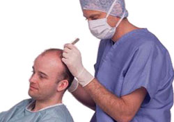 Hair Transplant Doctors