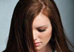 Hair Transplant in Women