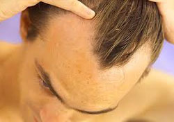 Hair Transplant Prices