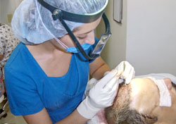 Hair Transplant Procedures