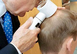 Hair Transplant Side Effect Hair Transplant Side Effect