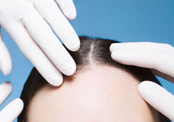 Hair Transplant Surgeons