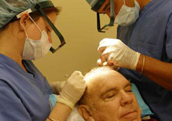 How Much is Hair Transplant How Much is Hair Transplant