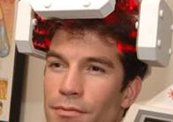 Laser Hair Transplant Laser Hair Transplant
